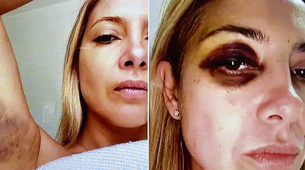 fabiola-yañez-golpes
